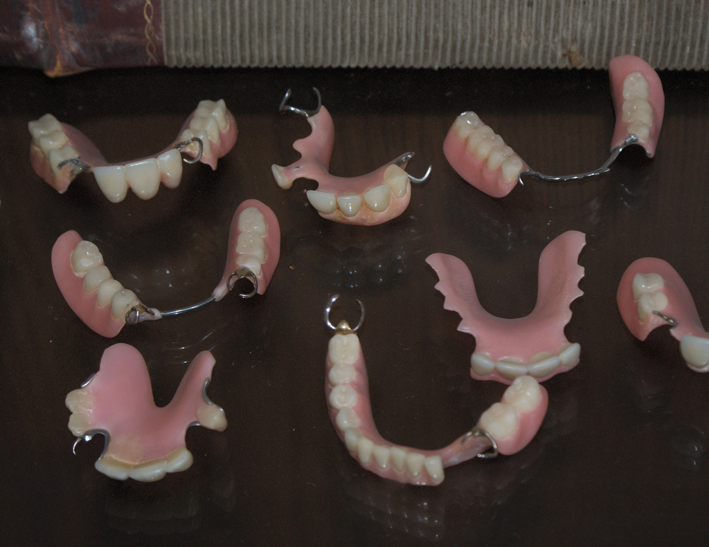 dentures dental flexible flippers implants denture tooth vs implant permanent getting partial teeth replacement than better cost removable right side